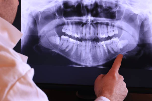 Best Weekend Emergency Dentist in Iowa Falls, IA